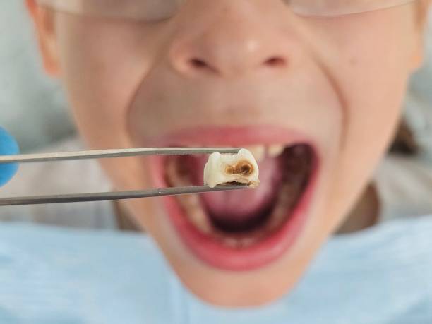 Best Knocked-Out Tooth Emergency  in Lepanto, AR